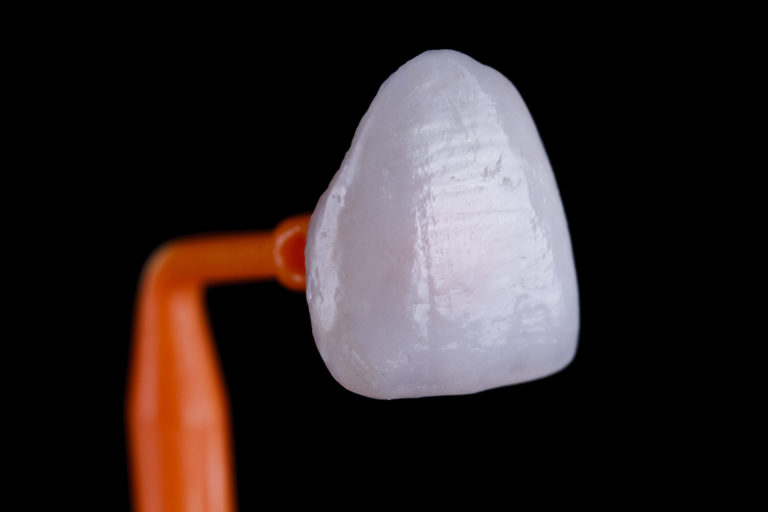_MG_6135B